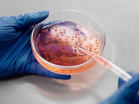 A gloved hand holding a culture plate in a laboratory
